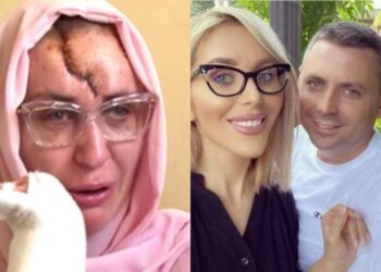 Confesiuni sfâșietoare făcute de Dana Roba! Va avea nevoie de mai multe operatii estetice!