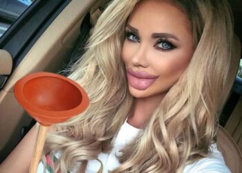 Bianca Drăgușanu și-a topit acidul hialuronic din buze! Diva a început o schimbare radicală: ”Îmi asum, că e greșeala mea”