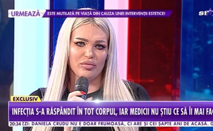 Preafrumoasa Loredana Loreens, în comă 12 ore din cauza unei interveții estetice!