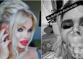 O bine-cunoscută vedetă din România, bătută crunt de un bărbat mascat, în București! ”Mă sufocam, nu aveam aer”