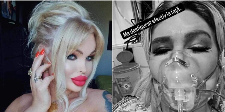 O bine-cunoscută vedetă din România, bătută crunt de un bărbat mascat, în București! ”Mă sufocam, nu aveam aer”