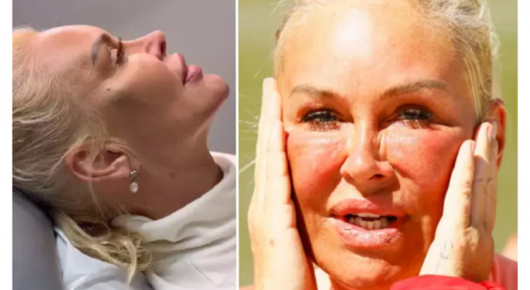 Preafrumoasa Vica Blochina și-a făcut un lifting facial care a întinerit-o cu cel puțin 20 de ani!