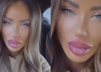 Frumoasa Bianca Drăgușanu a atins perfecțiunea! Natura are acum cu ce se mândri: buzele legendare ale divei frizează divinul